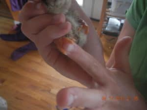Severely curled toes; she couldn't walk.